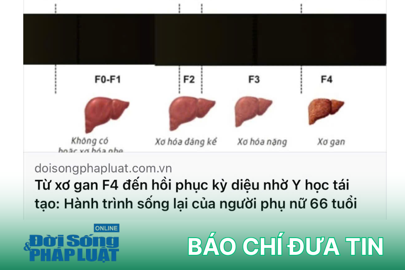 xơ gan f4 hồi phục nhờ Y học tái tạo