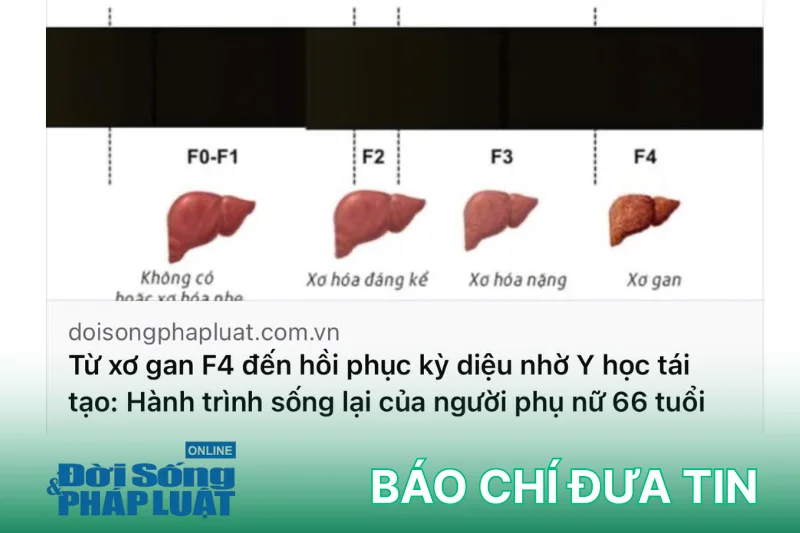 xơ gan f4 hồi phục nhờ Y học tái tạo