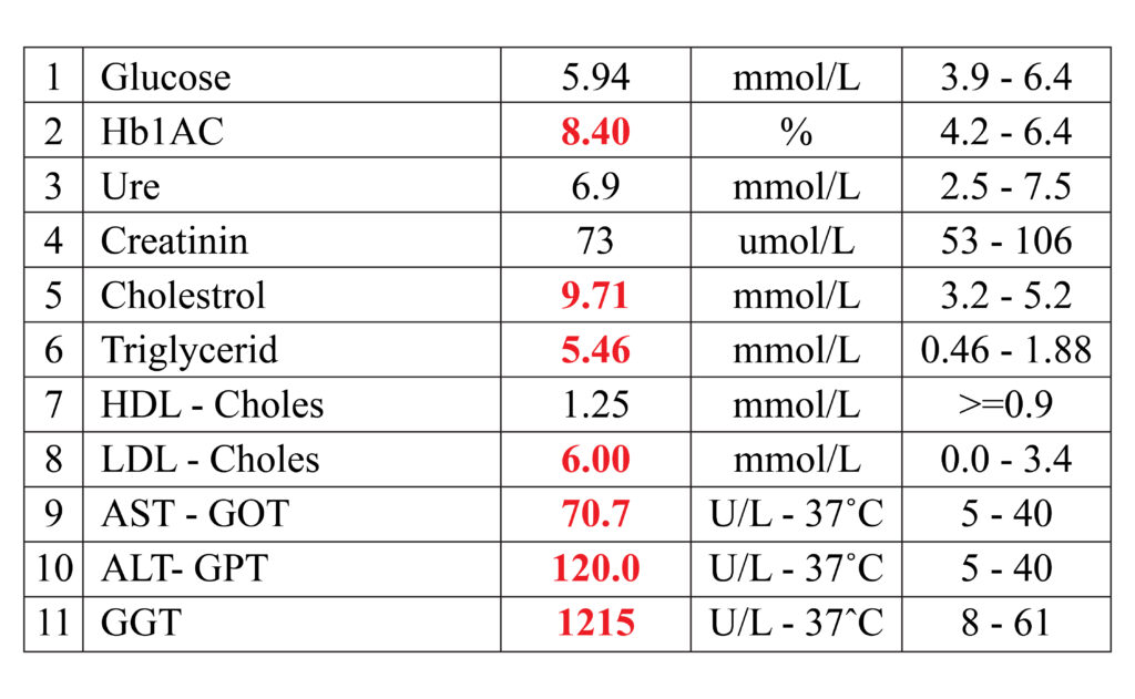 Kết quả xét nghiệm ban đầu (GGT=1215), điều trị xơ gan tự miễn 