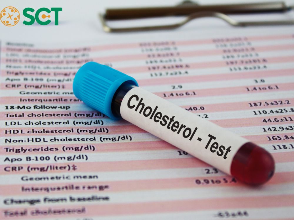 Hiểu về xét nghiệm và chuẩn đoán mỡ máu cáo cholesterol