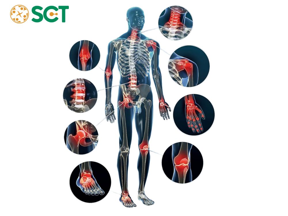 Vị trí khớp thường bị ảnh hưởng bởi viêm khớp dạng thấp trên cơ thể