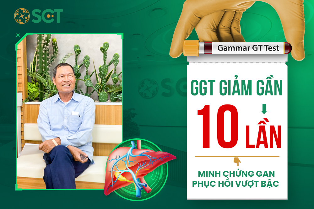 Chữa men gan cao tại phòng khám Đa khoa SCT