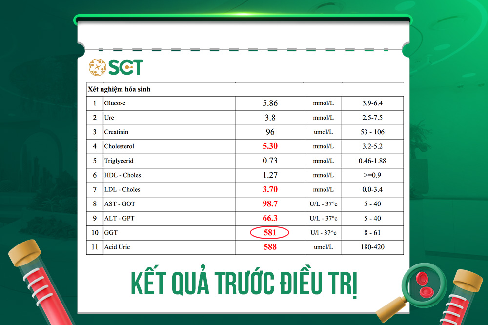 Các chỉ số xét nghiệm trước khi điều trị men gan cao