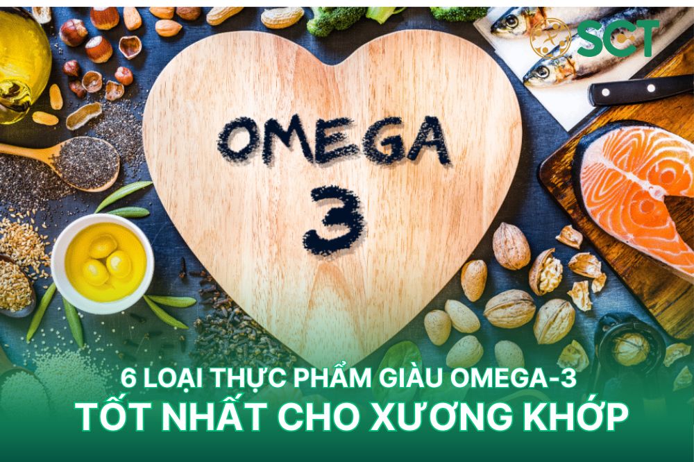 thực phẩm tốt cho xương khớp