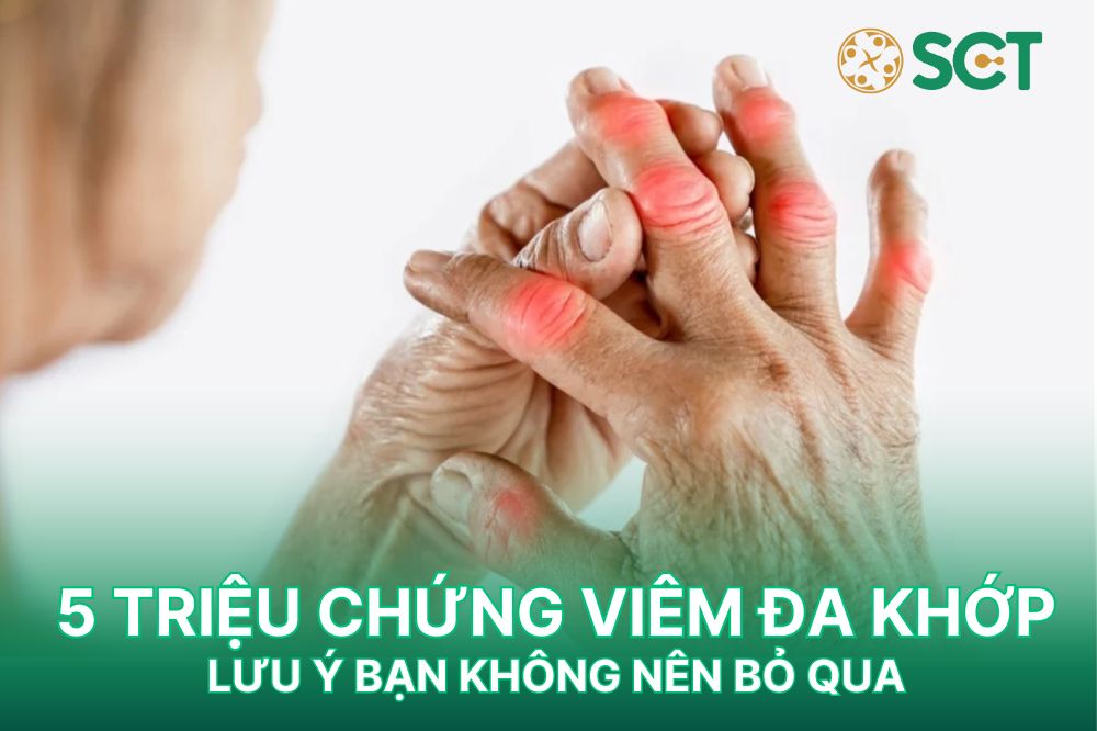 5 triệu chứng viêm đa khớp