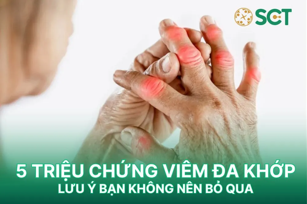 5 triệu chứng viêm đa khớp