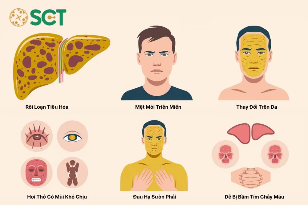 7 Dấu Hiệu Cần Thải Độc Gan Ngay Lập Tức? Chuyên Gia Cảnh Báo 3 Những dấu hiệu cần thải độc gan