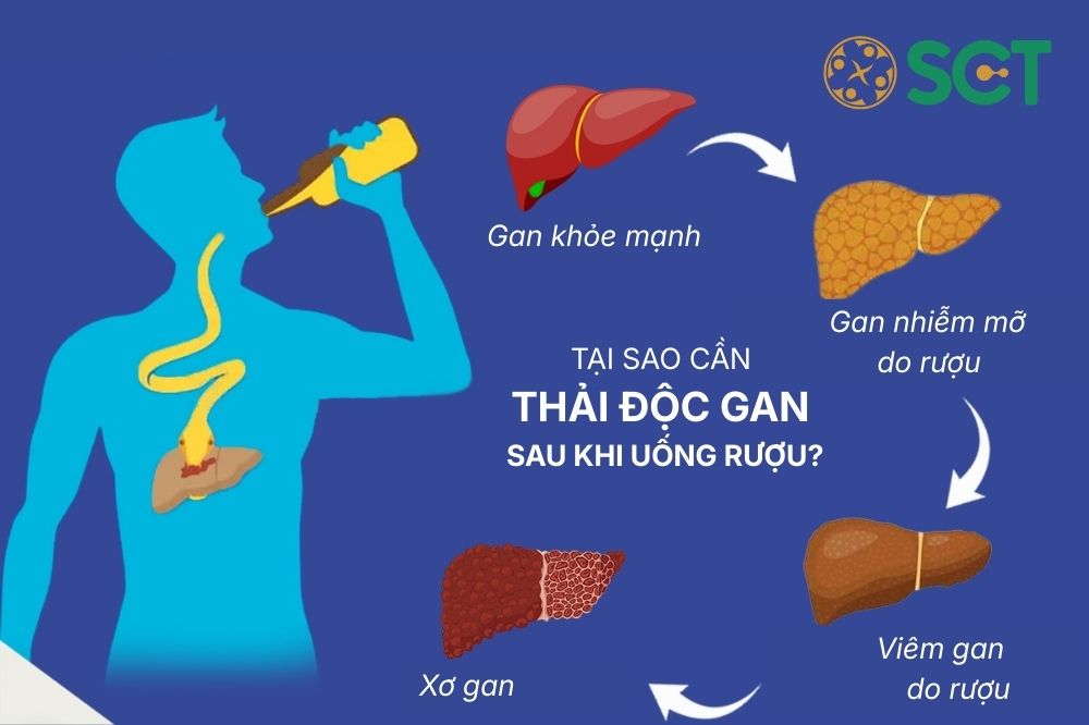 4 Cách Thải Độc Gan Sau Khi Uống Rượu Hiệu Quả Nhất Cho Quý Ông 2 Tại sao cần thiết phải thải độc gan sau khi uống rượu